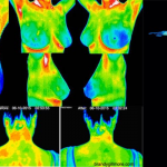 Medical Thermography. A Safe, Non-Invasive Window into Your Body’s Physiology