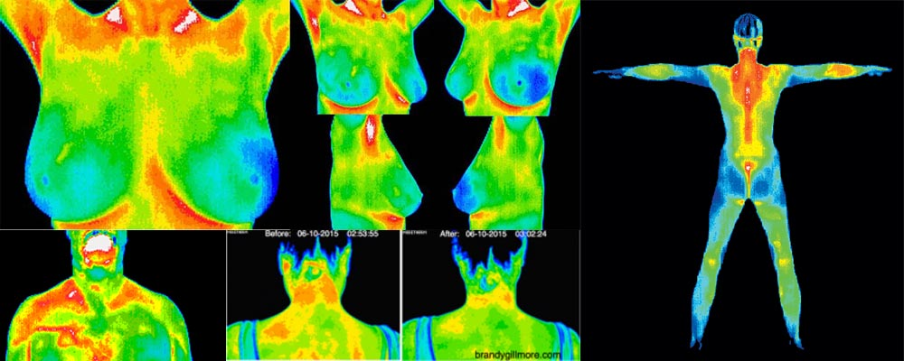 Medical Thermography.